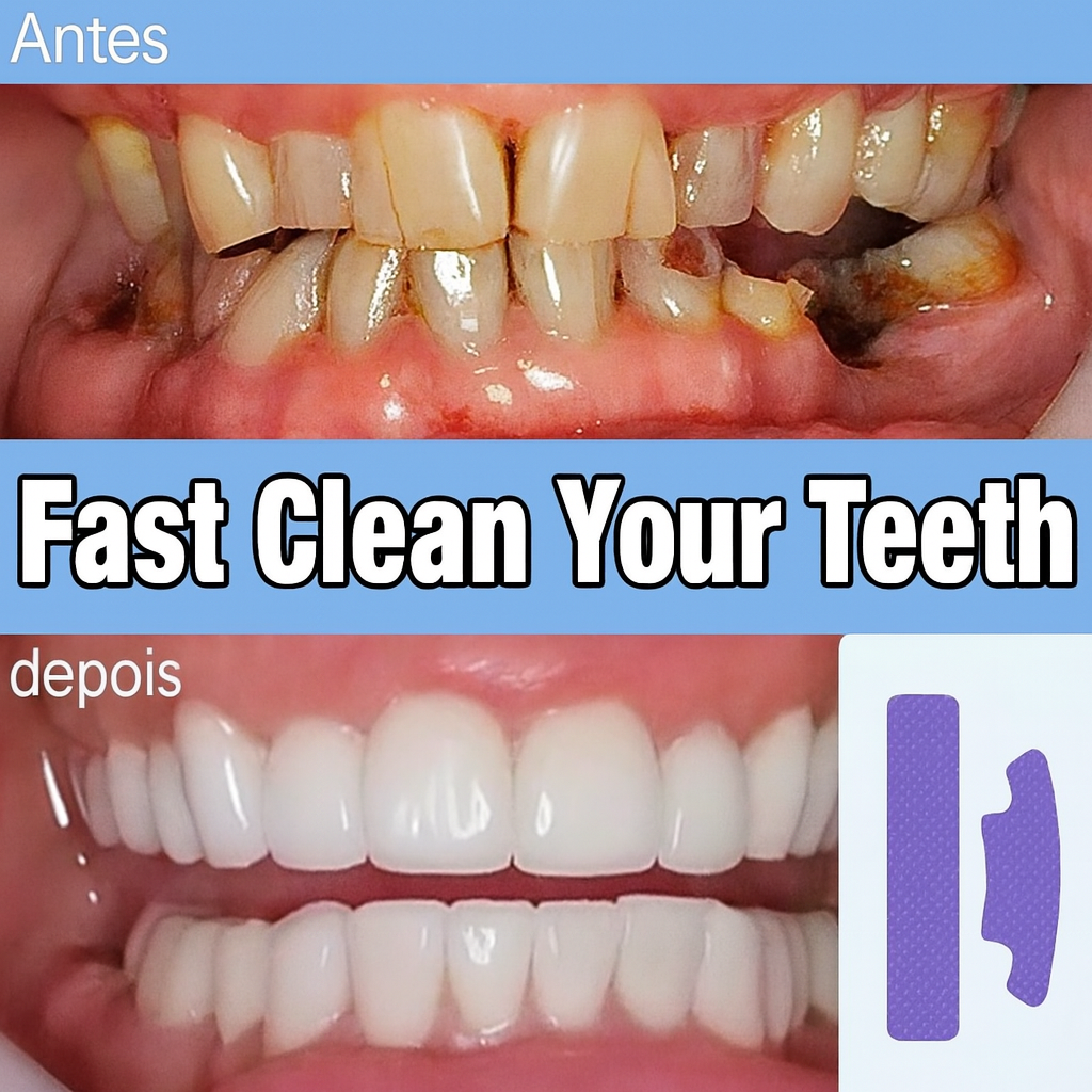 Purple Teeth Whitening Strips