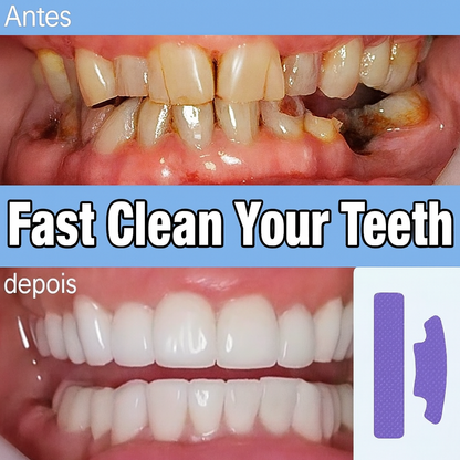 Purple Teeth Whitening Strips